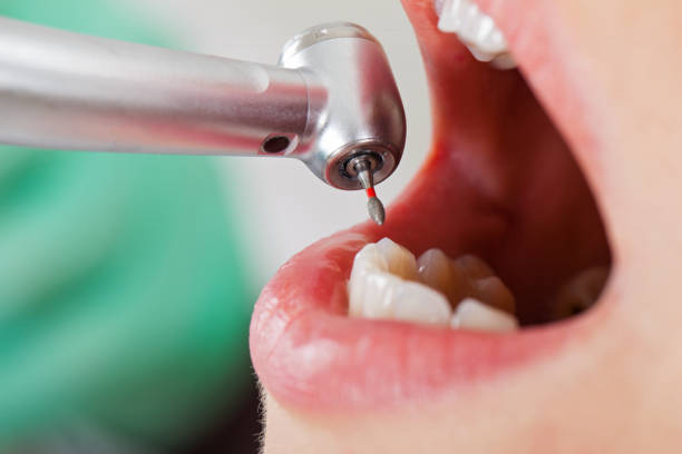 Best Knocked-Out Tooth Emergency  in Moorpark, CA